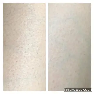 natura chuchuナトゥーラチュチュ所属・バスト体験 ナトゥーラチュチュのエステ・リラクイメージ