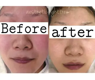 ショート カラー パーマ ヘアアレンジ メンズ キッズ ネイル マツエク・マツパ ニキビ&跡改善サロン オーナー光木のエステ・リラクイメージ