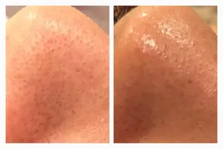 毒素出し専門サロンSylph(なかがわ整骨院併設サロン)所属・Mami Hataのエステ・リラクイメージ