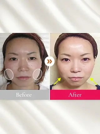 小顔整体研究所 KSラボ川崎店内田のエステ・リラクイメージ