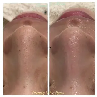 ビューティー ミロワールのエステ・リラクイメージ