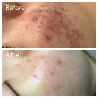 深い肌悩み専門 フェイシャルサロンのエステ・リラクイメージ