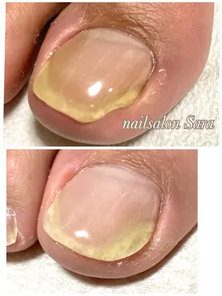 ネイル Sara所属・nailsalon Saraのネイルデザイン