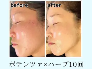 ブライダルエステ&肌管理OGUMO所属・肌管理 OGUMOのエステ・リラクイメージ