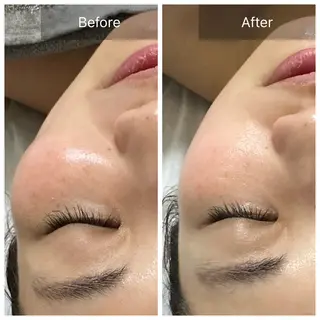 Bène Soin du Esthétique所属・逵中 元香のエステ・リラクイメージ