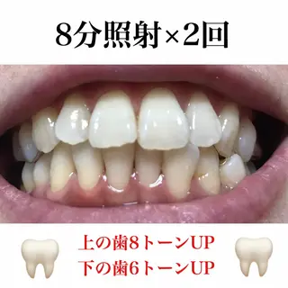 ネイル/耳つぼ /新ホワイトニングのネイルデザイン