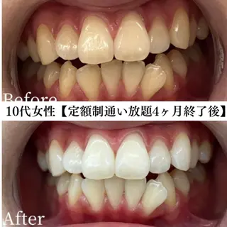 キッズ メンズ セルフホワイトニング専門店WHITE福岡天神店所属・セルフホワイト専門店 WHITE福岡天神店のエステ・リラクイメージ