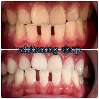 メンズ ホワイトニング ショップ川越店のエステ・リラクイメージ