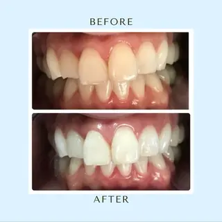 セルフホワイトニング サクッとホワイト 立川店所属・サクッとホワイト 立川店のその他イメージ