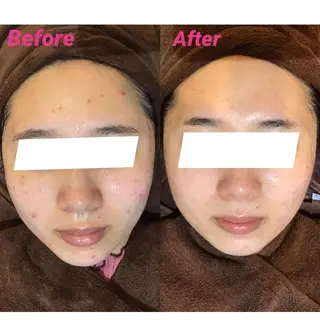 エヴァーグレース 河原町店のエステ・リラクイメージ