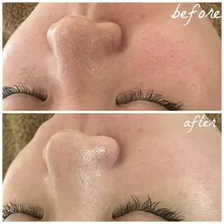 メンズ メナード岐阜茜部 杉浦のエステ・リラクイメージ