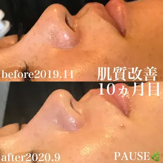 浜野 恵美のエステ・リラクイメージ