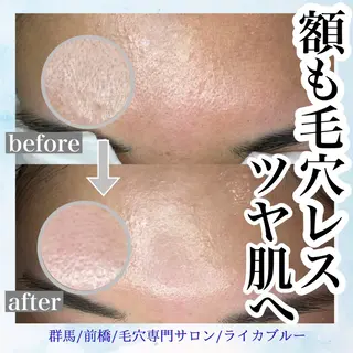 毛穴専門サロン ライカブルーのエステ・リラクイメージ