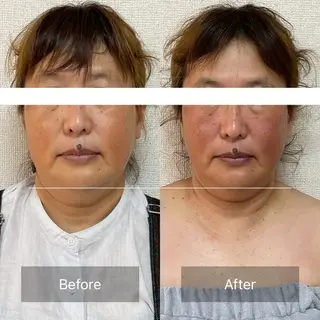 小顔＆肌質改善　お顔の印象所属・小顔×肌質改善 《お顔の印象》のエステ・リラクイメージ