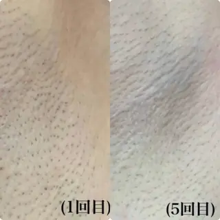 Beauty Salon AZUL所属・ビューティーサロン AZULのエステ・リラクイメージ