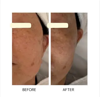 grow所属・Yoshino Erinaのエステ・リラクイメージ