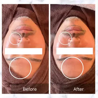 Lumiere despoir所属・Lumiere despoirのエステ・リラクイメージ