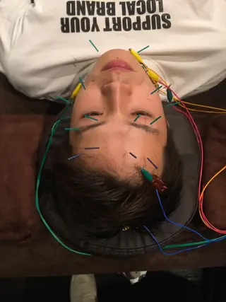 メンズ 表参道鍼灸院K 美容鍼🔮ララピールのエステ・リラクイメージ