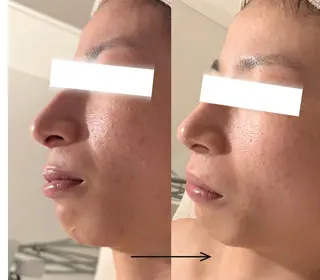 POLA THE BEAUTY 天王寺店所属・UEDA | POLA 天王寺のエステ・リラクイメージ