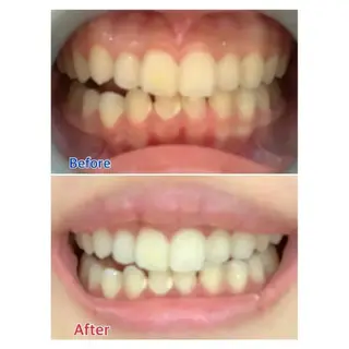 M渋谷店所属・M渋谷 ホワイトニングのエステ・リラクイメージ