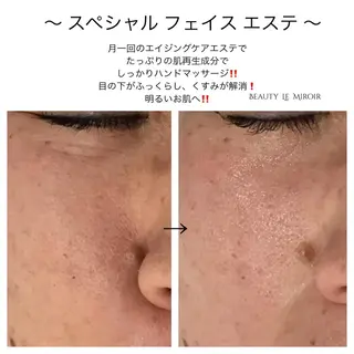 ビューティー ミロワールのエステ・リラクイメージ