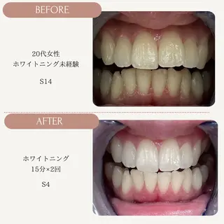 メンズ Whitening Carat 恵比寿店所属・ホワイトニング カラット 恵比寿店のエステ・リラクイメージ