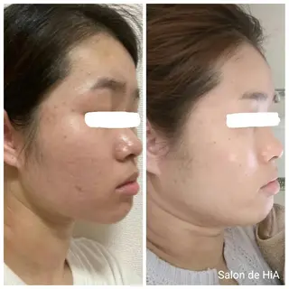 Salon de  HiAのエステ・リラクイメージ