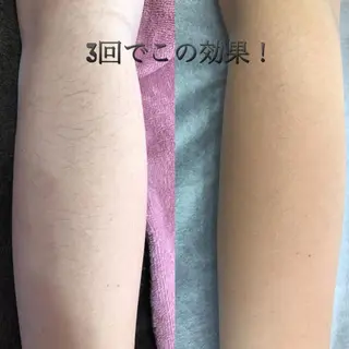 キッズ ネイル・脱毛サロンplage所属・脱毛サロン Plageプラージュのエステ・リラクイメージ