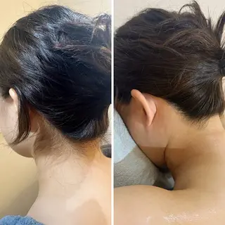 うなじ脱毛/美肌脱毛 LABELのエステ・リラクイメージ