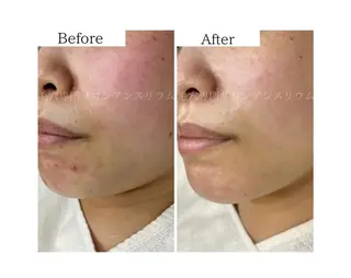 毛穴ケア専門サロンアンスリウム所属・茨城土浦 つくば毛穴 ケア専門サロンのエステ・リラクイメージ