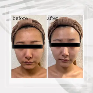 lumirise所属・lumi riseのエステ・リラクイメージ