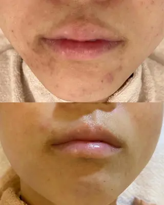 Le cherien所属・Le cherien ルシェリアのエステ・リラクイメージ