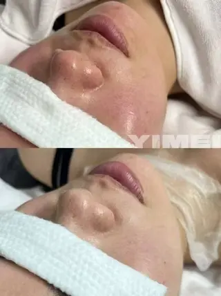 マツエク・マツパ aliaハイフ&水光ジェットサロン所属・aliaハーブ水光店 エステティシャン募集のエステ・リラクイメージ