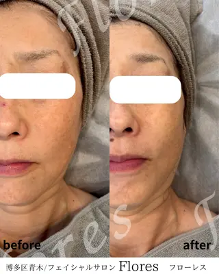 Flores所属・Flores- フローレスのエステ・リラクイメージ