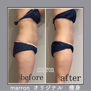 marron所属・痩身ハイパーナイフ ララピールリアボーテのエステ・リラクイメージ