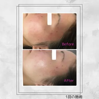 Bijou+幸手店所属・ビジュープラス幸手 由美のエステ・リラクイメージ