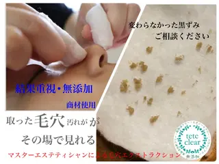 private salon  Dea_maris シュガーリング＆パーソナルボディケア所属・シミ改善・韓国肌管理 ボディメイク痩身のその他イメージ