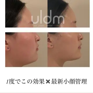 crescent所属・【韓国肌管理・脱毛】 クレセントのエステ・リラクイメージ