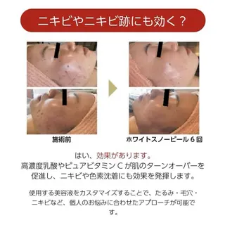 RinRin 山口店のエステ・リラクイメージ