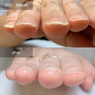 ネイル 木村 千晴のネイルデザイン