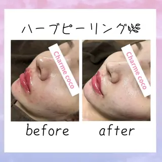 肌質改善Charme coco  増毛のエステ・リラクイメージ