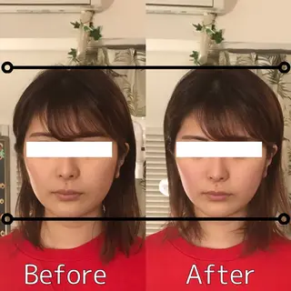 鍼灸salon mのエステ・リラクイメージ