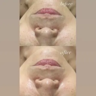 smileskin 御薗橋／meguのその他イメージ