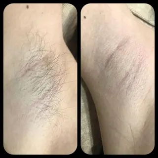 Rene 慢性疲労ケアサロンのエステ・リラクイメージ