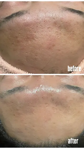 Ulu.肌質・体質改善専門サロン所属・後藤 真美のエステ・リラクイメージ