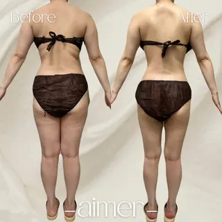 aimer 島田のエステ・リラクイメージ