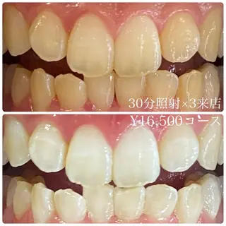 PLATINUM Beauty 横浜店所属・ホワイトニングルーム 横浜店のその他イメージ