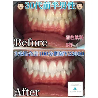 Whitening Beauty 行橋店所属・Whitening Beauty 行橋店のその他イメージ