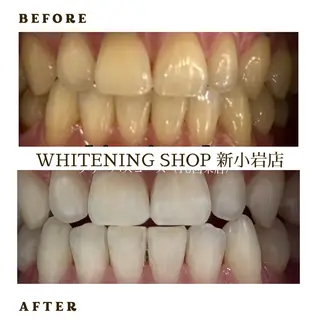 メンズ ホワイトニング ショップ新小岩店のその他イメージ