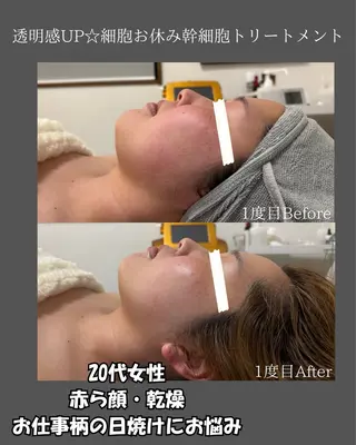 BLOSSOM 菊地のエステ・リラクイメージ